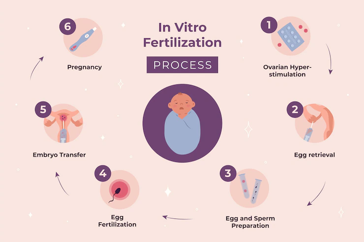ivf-process